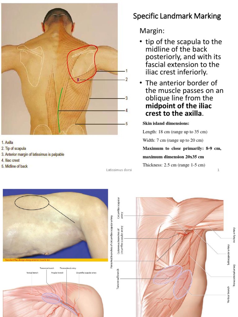 Latissimus Dorsi Muscle Flap