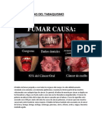 Consecuencias Del Tabaquismo