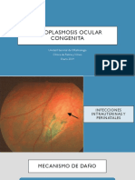 Toxoplasmosis Ocular Congenita
