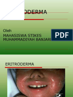 Slide Eritroderma 1
