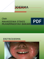 SLIDE ERITRODERMA 1.ppt