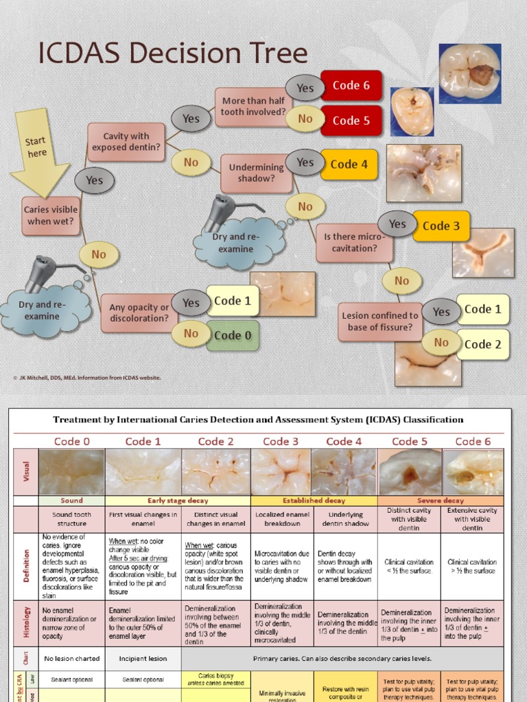 ICDAS Decision Tree: Code 6 Code 5 | PDF