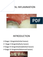 Gingival Inflammation