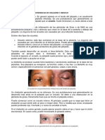 Diferencias de Chalazion y Orzuelo