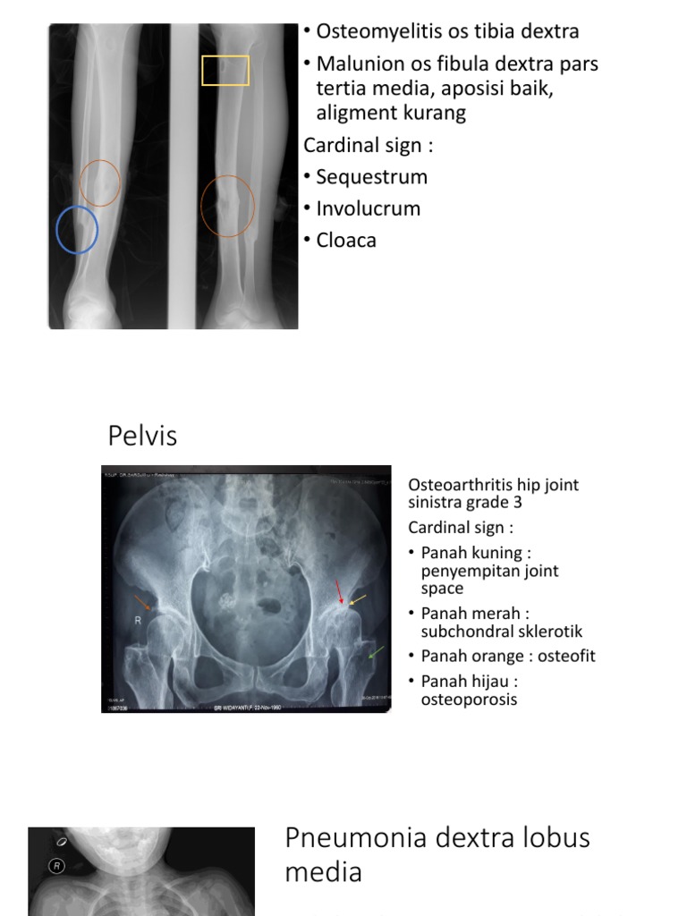 Kumpulan Gambar Radiologi 17202 | PDF