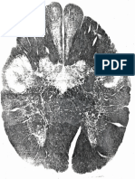 Crose Section of Brain