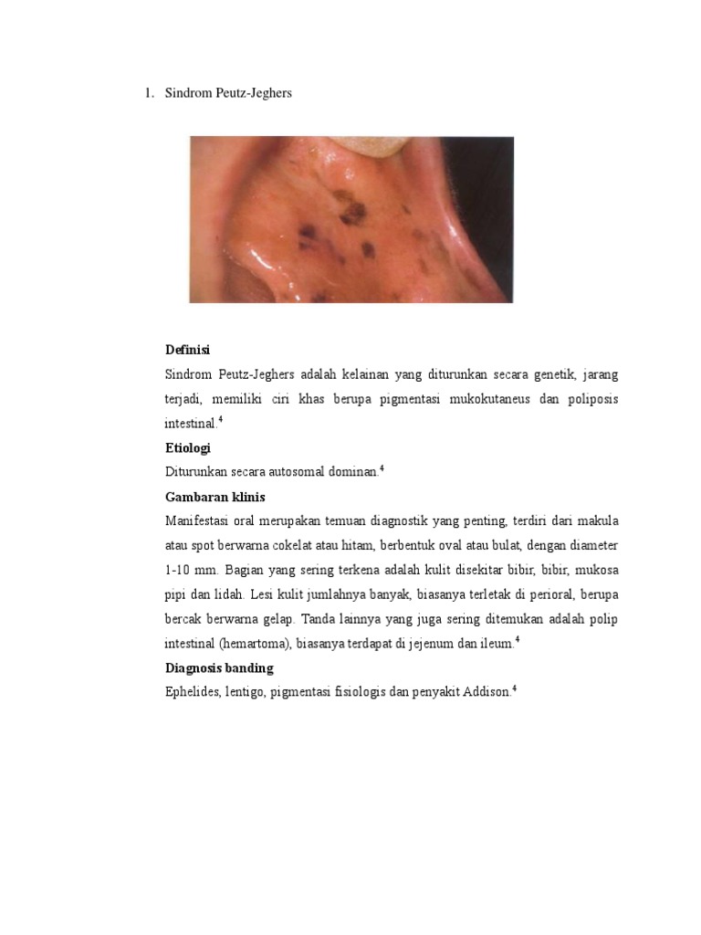 Envelope of Function PDF