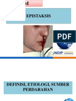 BBDM EPISTAKSIS