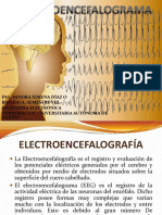 ELECTROENCEFALOGRAMA.pdf