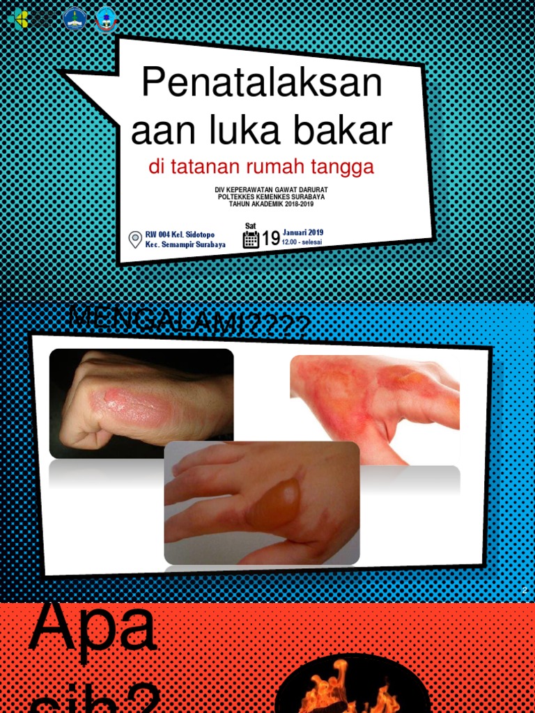 Penatalaksan Aan Luka Bakar: Di Tatanan Rumah Tangga | PDF | Blue | Color