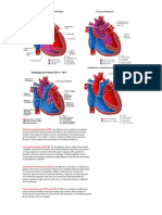 cardiopatias