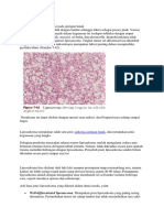 Liposarcoma