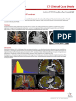 PE Study Using 30mL of IV Contrast