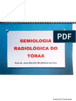 Semiologia Radiologica Do Tórax
