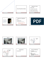 Classe II MX PDF