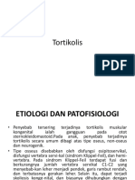 Torsicollis Congenital