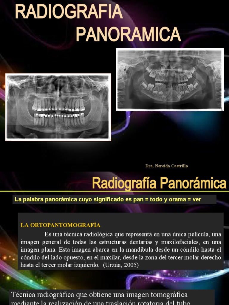 PANORAMICA PPSX | PDF | Rayo X | Imagenes medicas