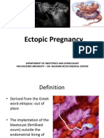 Ectopic Pregnancy