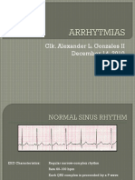 EKG Rhythm Characteristics and Etiologies