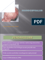 Hidrosephalus