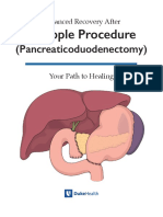 Whipple Procedure: (Pancreaticoduodenectomy)