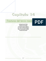 fx del tercio medio facial.. cuidados perioperatorios.pdf