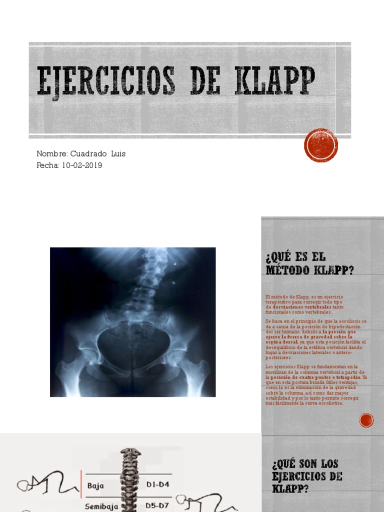 Diapositivas Ejercicios de Klapp | PDF | La columna vertebral | Escoliosis