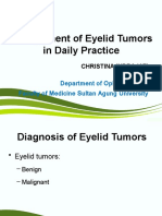 Management of Eyelid Tumors in Daily Practice