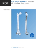 Synthes-LCP Condylar Plate 4.5-5.0