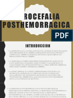 hidrocefalia posthemorragica