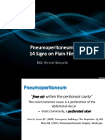 pneumoperitoneumsigns-140810105221-phpapp02
