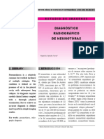 Diagnostico de Neumotorax