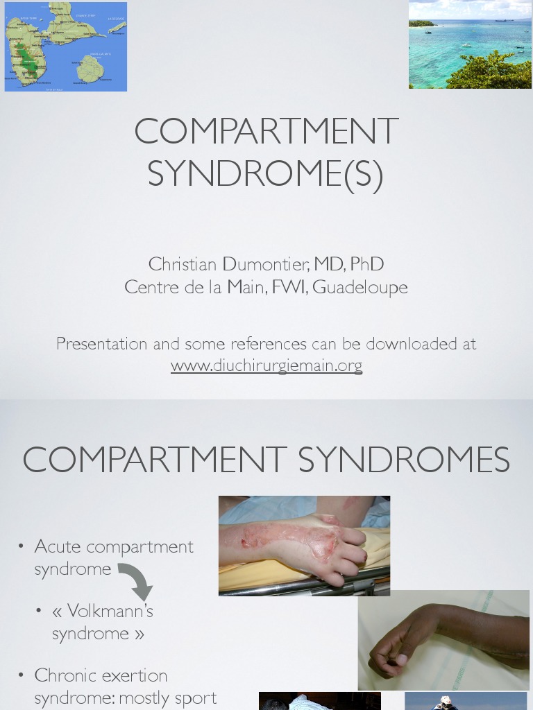 Compartment Syndrome Hand and Forearm PDF Diseases And Disorders