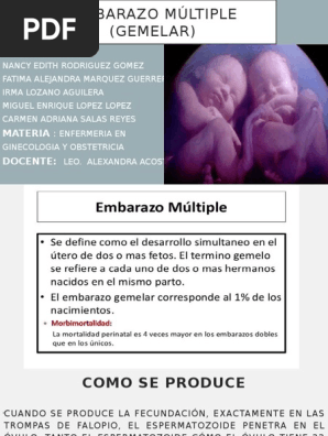 Embarazo Múltiple Gemelar