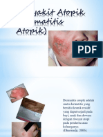 DERMATITIS ATOPI