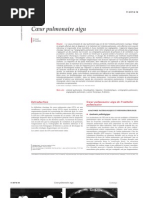 Download Cur pulmonaire aigu by drlauri SN39969210 doc pdf