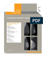 Classification BI-RADS: Densité Mammaire: Fiche Technique