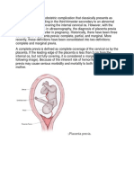 Placenta previa is an obstetric complication that classically presents as painless vaginal bleeding in the third trimester secondary to an abnormal placentation near or covering the internal cervical os.docx