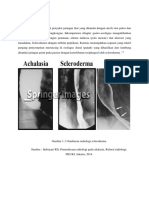 DIAGNOSIS BANDING SKLERODERMA DAN KARSINOMA ESOFAGUS