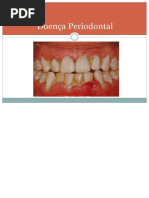 AULA Periodontia 