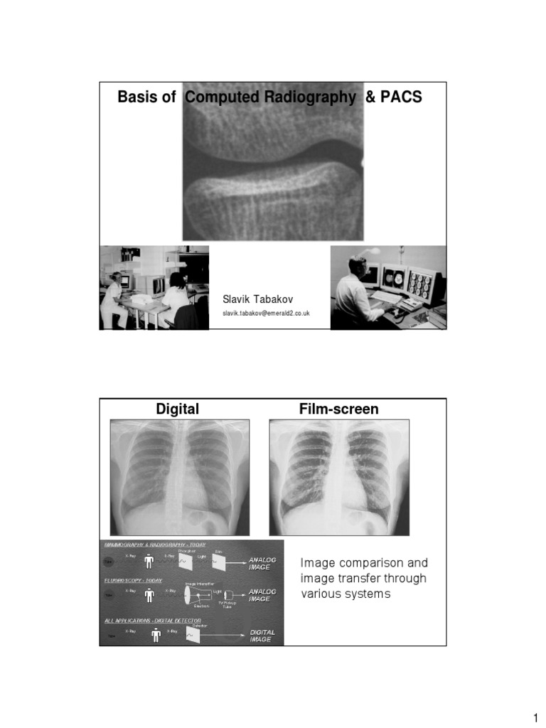 Computed Radiography and PACS Overview | PDF | Charge Coupled Device ...