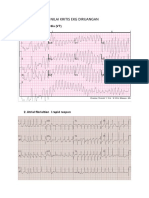 Nilai Kritis Ekg Diruangan