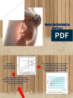 macrosomia.pptx