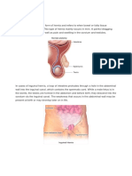 Pathophysiology Inguinal Hernia