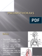 Pneumothorax