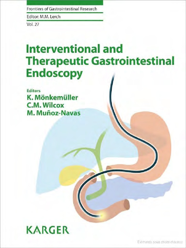 Interventional Endos Pdf Endoscopy Aspirin