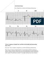 T wave changes cerebral hemorrhage