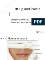 Cleft Lip and Palate