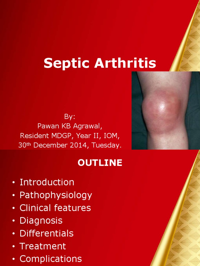 Septic Arthritis By Pawan KB Agrawal, Resident MDGP, Year II, IOM, 30