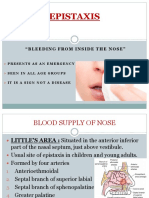 Epistaxis: "Bleeding From Inside The Nose"